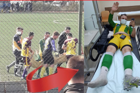 kozcagizda-genc-futbolcunun-ayagi-kirildi1