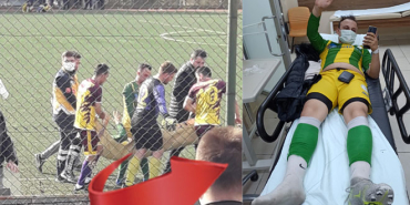 kozcagizda-genc-futbolcunun-ayagi-kirildi1