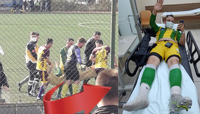 Kozcağız’da talihsiz olay! Genç futbolcunun ayağı kırıldı